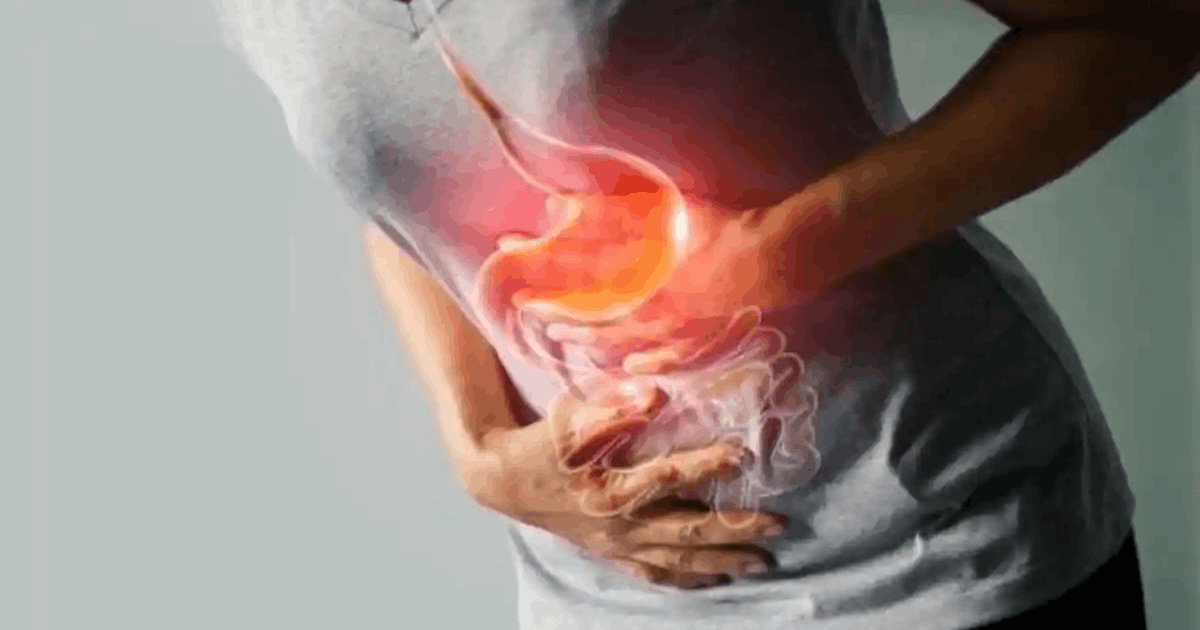 Apakah GERD Bisa Memicu Kematian Mendadak? Simak Penjelasan Dokter