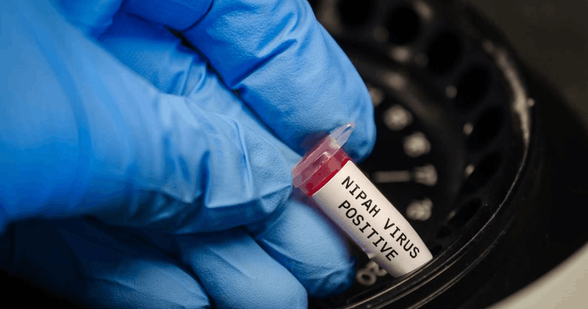 Kemenkes Perketat Pintu Masuk! Upaya Pencegahan Virus Nipah di Indonesia