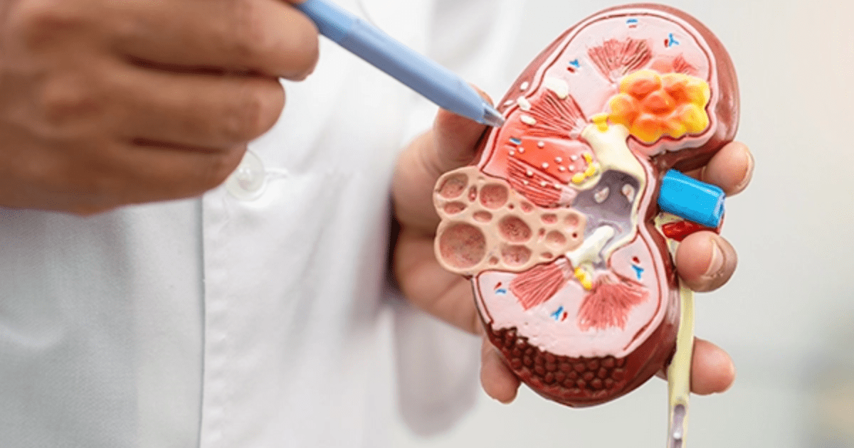 5 Makanan Untuk Kesehatan Ginjal: Bantu Detoks Racun