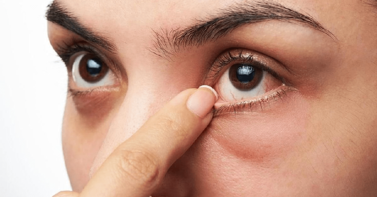 Kenali Sederet Penyebab Mata Mengantuk, Ternyata Bukan Hanya Ptosis