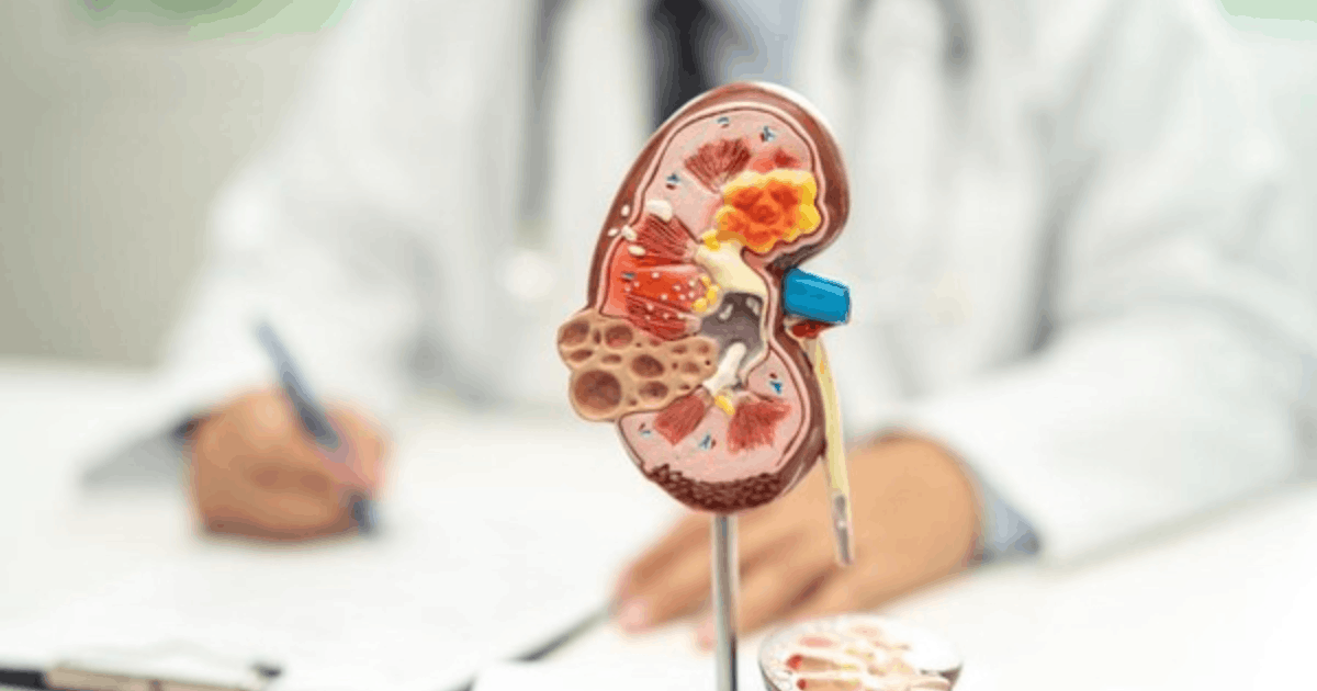 gagal ginjal usia muda