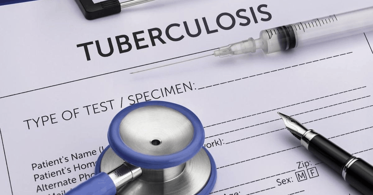 Bahaya Penularan TBC Diam-Diam: Pakar Peringatkan Epidemi di Malaysia