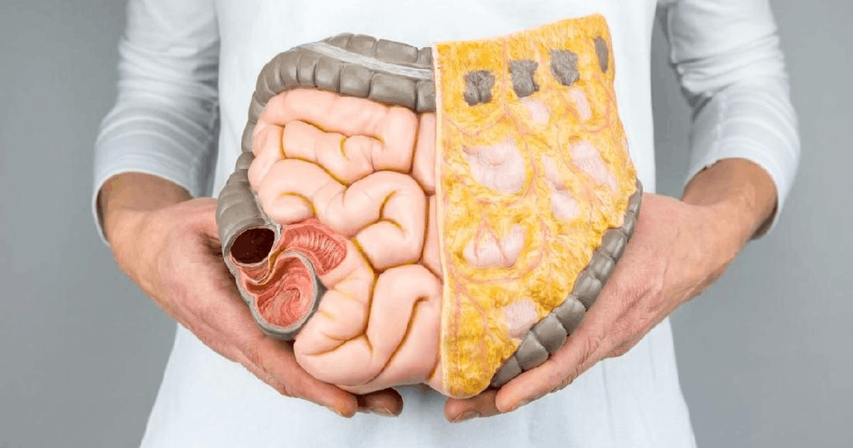 Gejala Kanker Usus Muda: Waspadai Tanda yang Sering Anda Abaikan