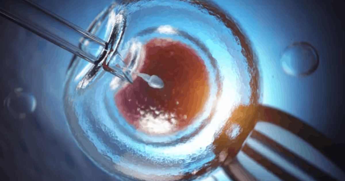 Malpraktik Klinik Kesuburan: Pasangan Kulit Putih Lahirkan Bayi Ras Lain