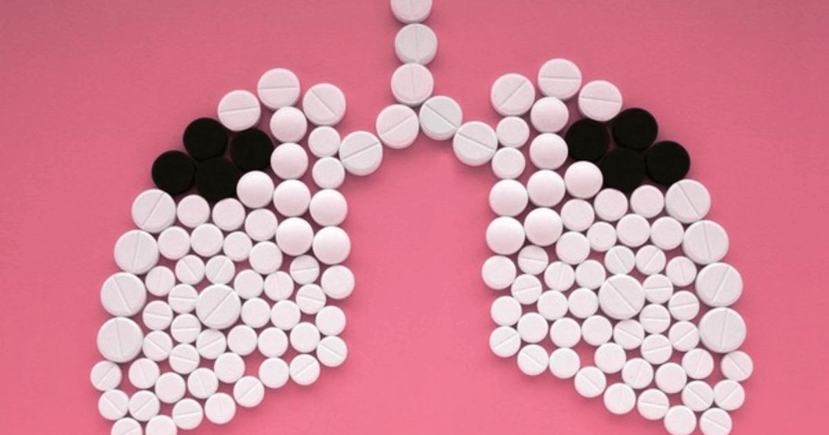 Pelaporan Kasus TB Malaysia: Pakar Sarankan Indonesia Tiru Cara Ini