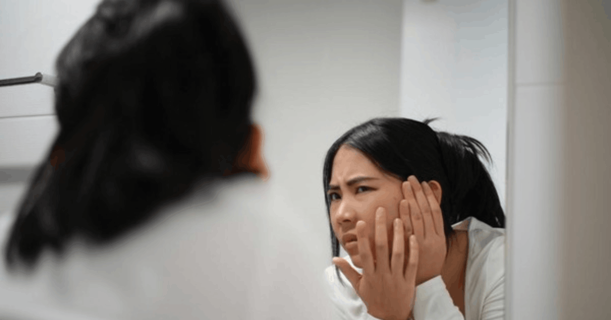 Diet Rendah Gula Atasi Jerawat: Simak Fakta Medis dan Manfaatnya!