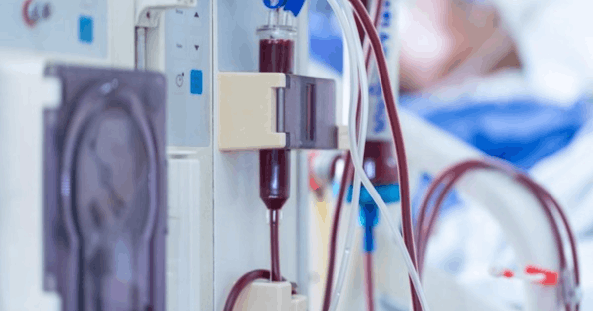 Dokter Respons Kasus BPJS Pasien Cuci Darah Nonaktif: Ini Sangat Berisiko!