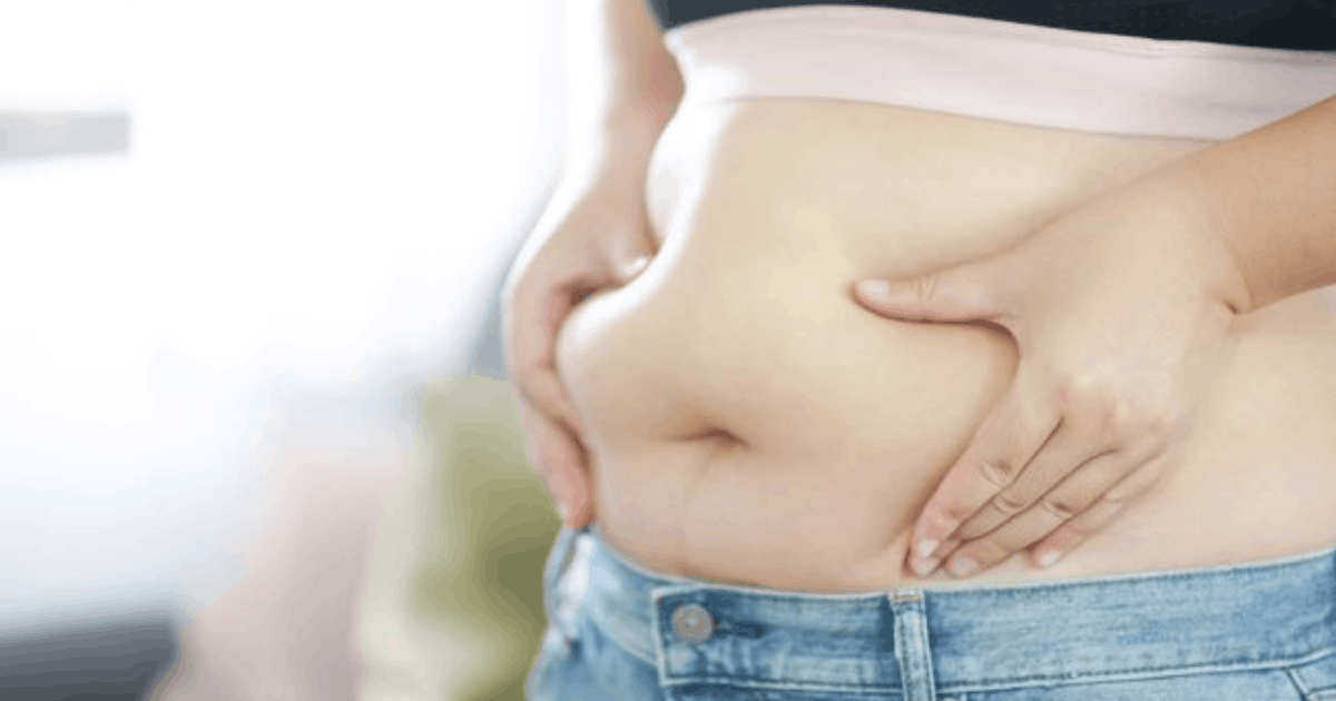 Perut Buncit Kista Ovarium atau Lemak? Ini Kata Dokter Obgyn