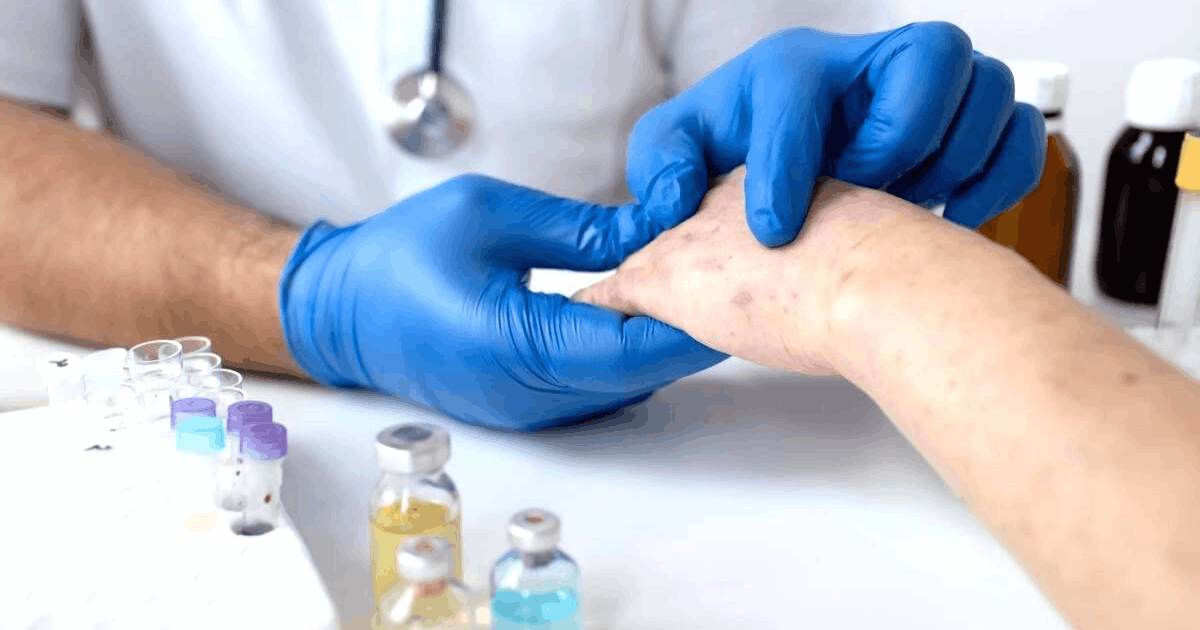 Dokter Internship Meninggal Campak: Kemenkes Soroti Antivaksin