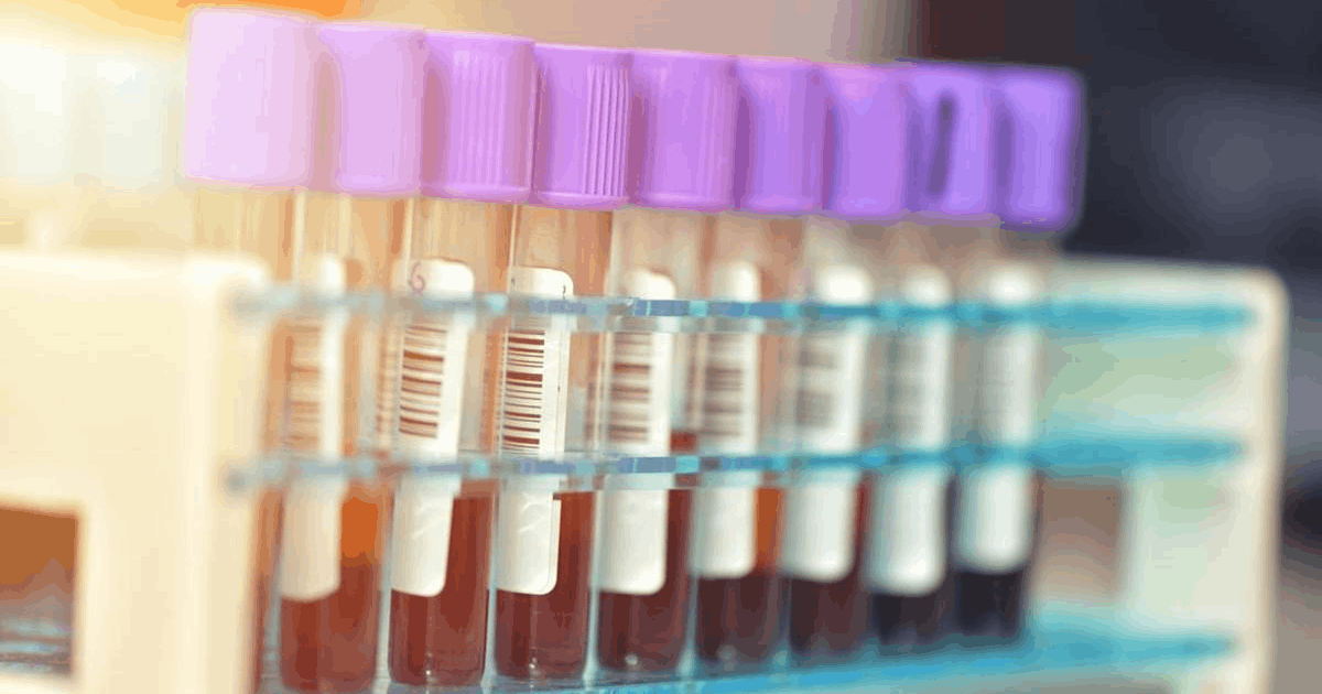 Mpox bangkit lagi Singapura