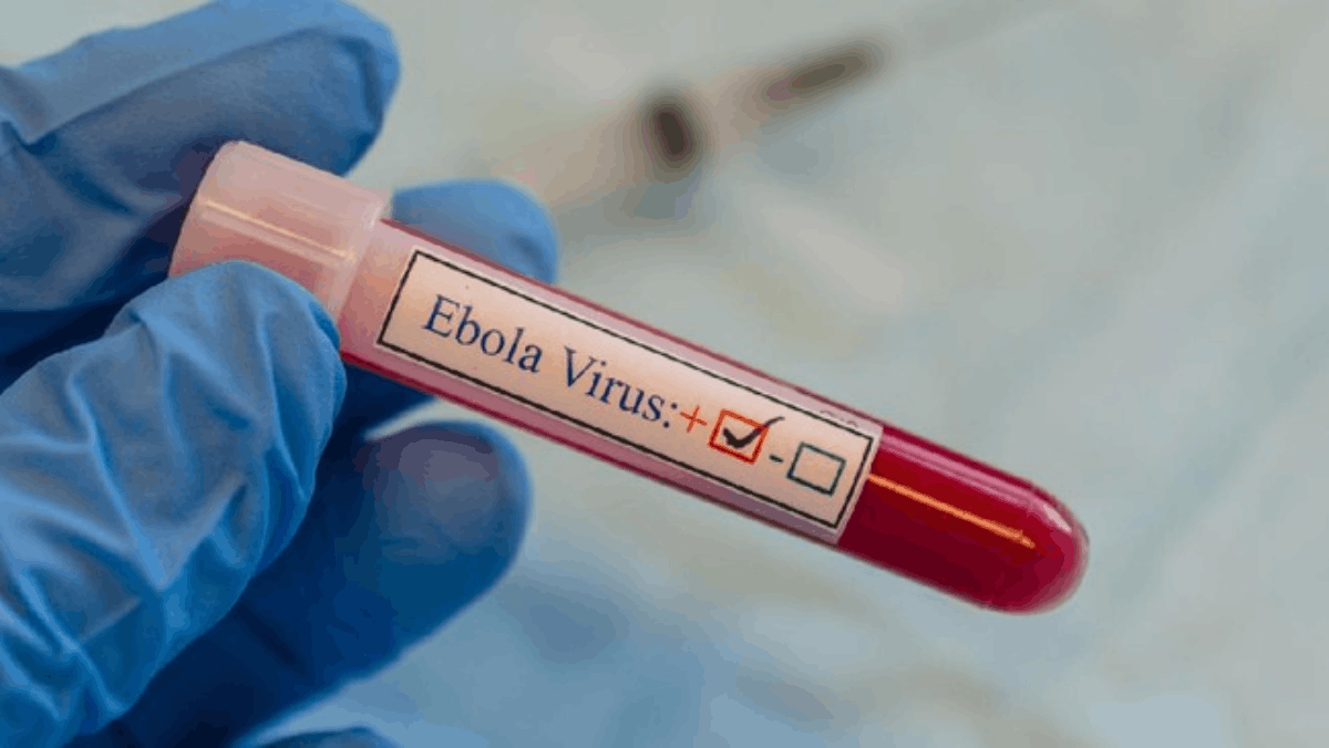 Wabah Virus Marburg Bangkit Lagi, 65 Orang Meninggal