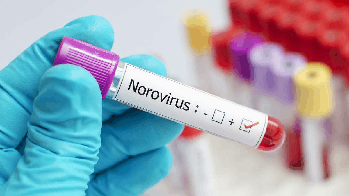 Infeksi Norovirus